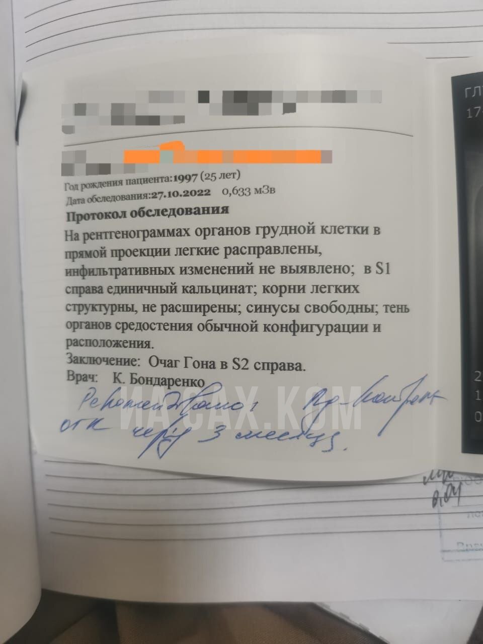 Сахалинцу с подозрением на туберкулез предлагают долечиться в зоне СВО.  Сахалин.Инфо